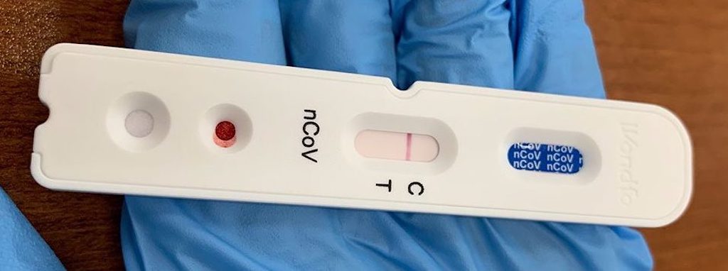 Covid Rapid Test